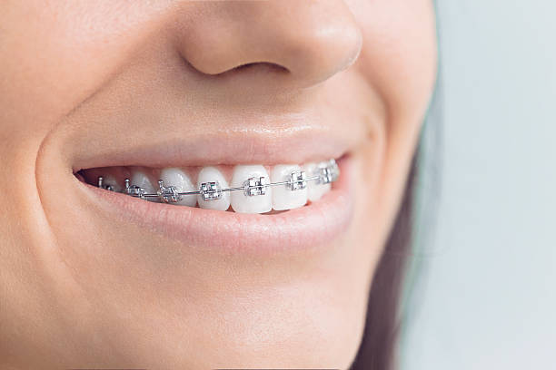 Dental Bonding in Oak Point, TX